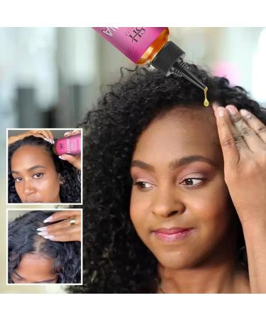  Zankie 1/3 Batana Oil for Hair Growth - 40ml - Batana Oil for Dry and Nourishing Hair - Leave-In Repair Oil - Hair Root Straightening Oil for - Buy Online on GoSupps.com