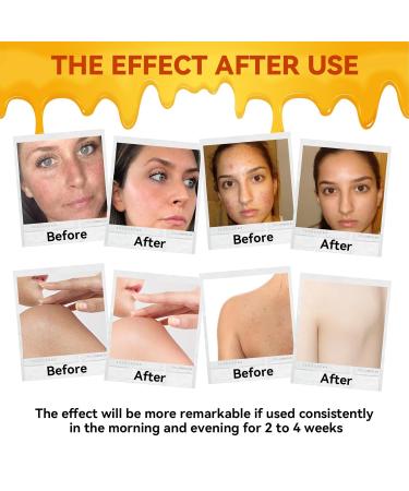 CKOWAJN Beef Tallow for Skin Gentle Beef Tallow for Face Organic Grass-Fed Beef Tallow & Raw Honey Tallow and Honey Balm for Skin Body & Face Moisturizer for Soft Smooth Skin - Buy Online on GoSupps.com