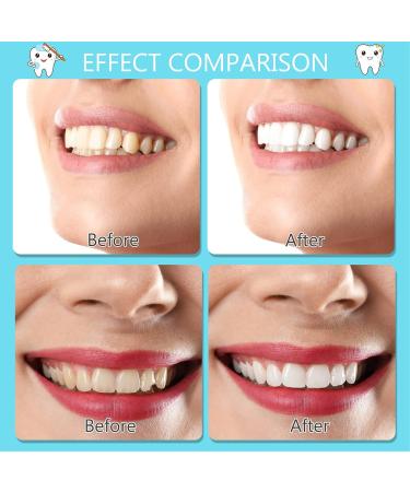 Wrong Teeth Veneers - Comfortable White Dentures for Men & Women | Upper & Lower Jaw Fake Teeth Set - Buy Online on GoSupps.com