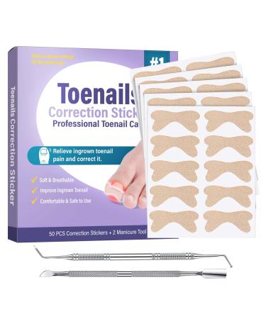 Ingrown Toenail Treatment 50Pcs Ingrown Toenail Corrector Strips Professional & Safe & Efficient &Painless ingrown toenail tool with 2 professional pedicure tools Suitable for All Nail Sizes 50 Count