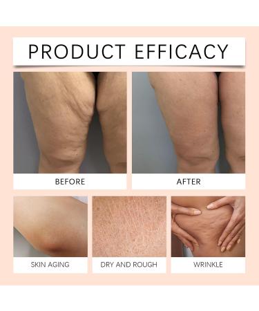 Skin whitening cream facial moisturizing cream 100 g gel intensive care for pigment spots irregularities and dryness for daily use - Buy Online on GoSupps.com