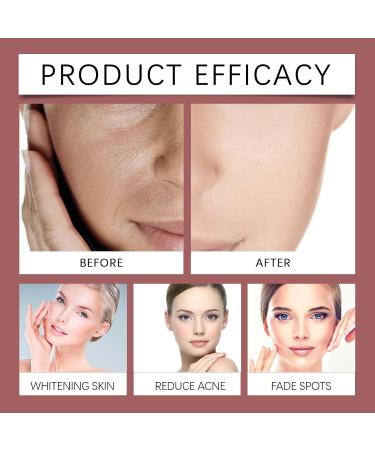 VKaoess Intensive peeling solution Discoloration correction serum dark spot correction for face and body helps fade age spots and sun spots 30 ml 8 bottles - Buy Online on GoSupps.com