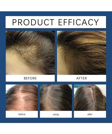 Rubu22a Rosemary oil blueberry hair oil suitable for women and men pure natural cosmetics for hair and scalp nourishing scalp treatment 100 ml 033 ml 300er Pack - Buy Online on GoSupps.com