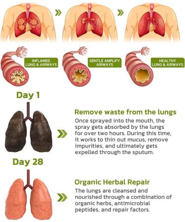 GFOUK BreathDetox Herbal Lung Cleansing Spray Herbal Lung Cleanse Spray Breath Detox Herbal Lung Cleansing Spray Herbal Lung Cleanse Mist - Powerful Lung Support (5pcs) - Buy Online on GoSupps.com