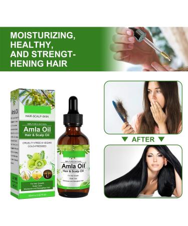 Amla Oil - Amla Hair Oil - Indian Amla Oil for Hair & Skincare - 100% Natural - Amla Oil for Natural Beautiful Long Soft & Strong Hair - Indian Hair Oil for Skin and Face (1) - Buy Online on GoSupps.com