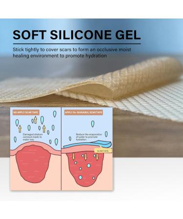Medical Grade Silicone Scar Tape - 164x1.57 Roll for Scar Removal | C-Section Tummy Tuck Keloid & Surgical Scars | Reusable Silicone Scar Sheets - Buy Online on GoSupps.com