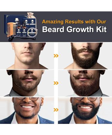 Beard Growth Kit - Derma Roller, Oil & Balm for Fuller Facial Hair | Perfect Gift for Men - Buy Online on GoSupps.com