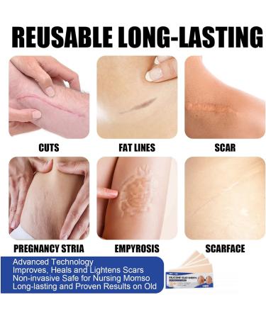 Scar Removal Tape - Transparent Sheets for Scald Scars - 4pcs (4*7.5cm) - Buy Online on GoSupps.com