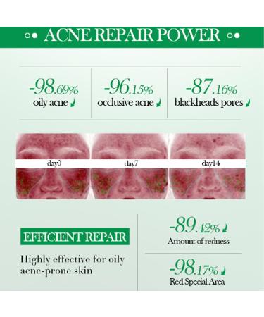 Salicylic Acid Repair Cream - Face Moisturizer for Acne-Prone Skin | Pore Shrinkage & Scar Improvement | 50g - Buy Online on GoSupps.com