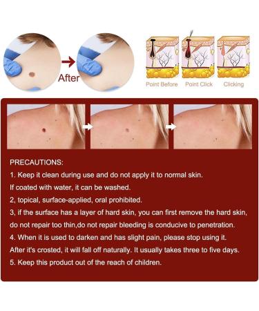 ZHBiwmatn 2024 New 5Pcs Wipe Off and Extreme Skin Wipe Off & Fast Easy to for Face Armpit Flesh Neck 3ml - Buy Online on GoSupps.com