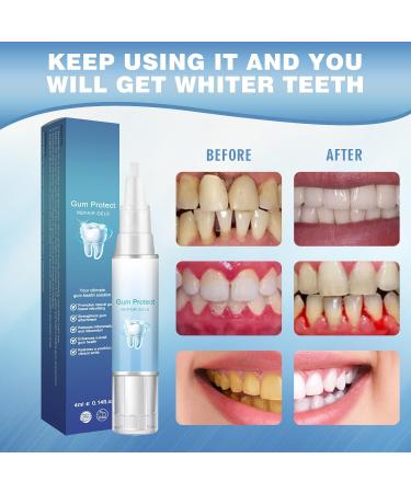 5-Piece Gum Therapy Gel Set | Effective Gum Protection & Teeth Whitening - Buy Online on GoSupps.com