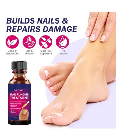 Extra Strength Toenail Fungus Treatment - Antifungal Solution for Nail & Athlete's Foot Care - Buy Online on GoSupps.com