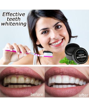 Natural Activated Charcoal Tooth Whitening Powder - 2 Pack for Stain Removal & Bright White Teeth - Buy Online on GoSupps.com