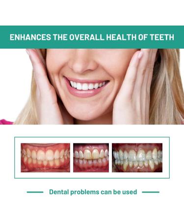 Lenaro Probiotics Teeth Mousse Set - Bright Whitening & Gum Health (3PCs) | Herbal Oral Repair & Bad Breath Solution - Buy Online on GoSupps.com