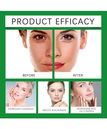 FFEEJ Aloe Vera Cleansing Foam Gentle Facial Cleanser For Deep Pore Cleaning Hydrating Oil-Control Moisturizing & Non-Tightening - Buy Online on GoSupps.com