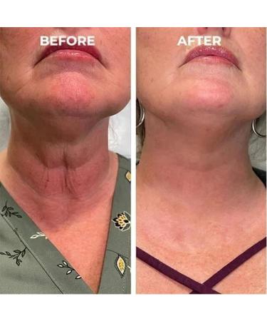 Skin Firming Rejuvenating Moisturising Essence with Hyaluronic Acid Firming Cream for Face and Neck Moisturising Firming Face Firming - Buy Online on GoSupps.com