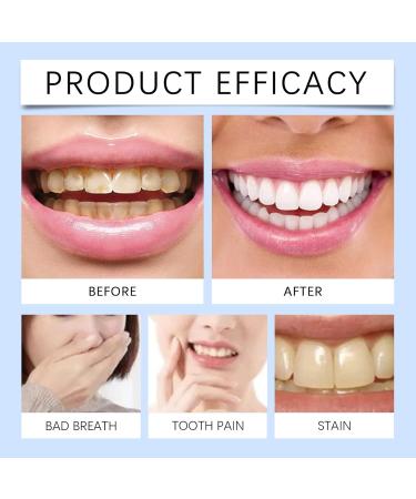 BOULCHWASH Tonsils - 120ml Effective Mouthwash Tonsils Remover Stone | Competitive Rinsing Liquid-Wash | Deodorant Liquid for Adults Dry Skin Embossed - Buy Online on GoSupps.com