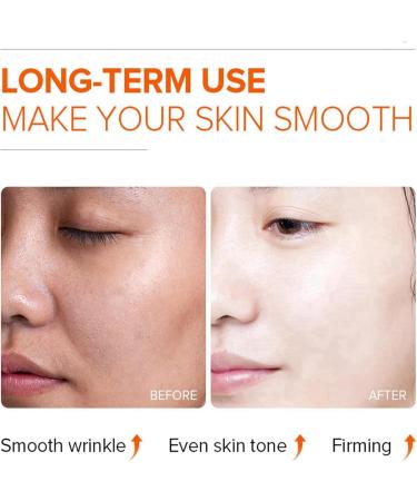 Vitamin C Moisturiser For Face Cream Face Moisturiser Vitamin C Facial Moisturiser Day And Night Cream For Women Brighten Tone Face Brightening Cream Brighten Anti Wrinkle Cream Skin Lightening Cream - Buy Online on GoSupps.com