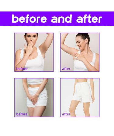 G neric 1/2/3pcs 2026 New 60ml Crema Para Manchas Oscuras En La Cara crema Para Las Manchas De La Cara Para Piel Entrepierna Manchas Codos Piernas Zonas Rodillas Cuello (1pcs) - Buy Online on GoSupps.com