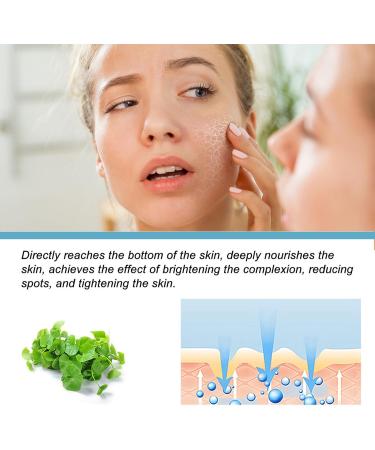 Nmbol Skin Lightening Serum B5 Spot Correction Serum B5 Corrector Serum Pigment Spot Remover Serum B5 Against Pigment Spots Wrinkle Reduction and Adolescent Radiation - Buy Online on GoSupps.com