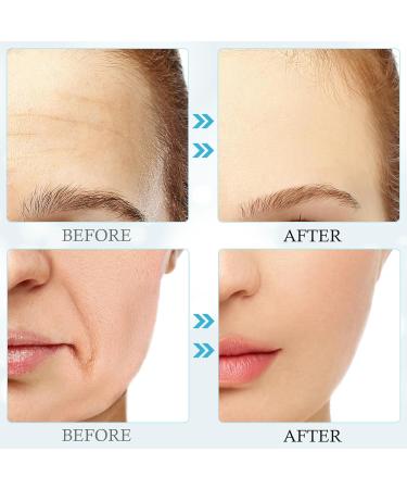 Forehead Wrinkle Patches 5Pc Silicone Reusable Anti-Aging Facial Treatment for Women | Smooth Forehead Eye & Mouth Wrinkles - Buy Online on GoSupps.com