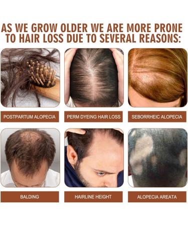 Batana Oil for Healthy Hair Batana Oil for Hair Growth Nourishes Thin Hair Scalp Skin and Loss Hair Growth Natural Batana Oil Promotes Hair Wellness for Men & Women Hair Care Hair Treatment(50ml) - Buy Online on GoSupps.com