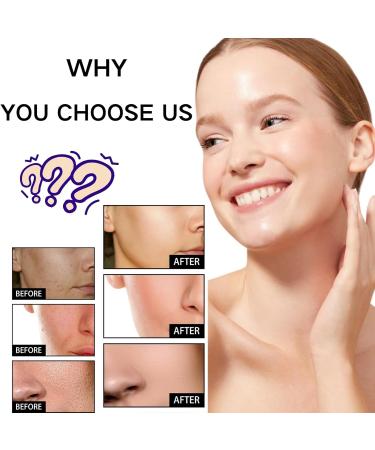 Tongyend Niacinamide Face Serums Niacinamide Serum Pore Minimizer & Brightening Facial Essence With Hyaluronic Acid Moisturiser For Acne Scar Lightening Skin Rehydration Pore Refinement and Soothing - Buy Online on GoSupps.com