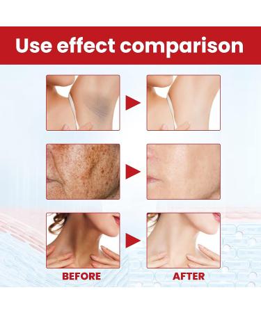Dark Spot Remover for Face & Body - Age, Brown, Sun Spot & Freckle Remover for Men & Women - 0.04 oz - Buy Online on GoSupps.com
