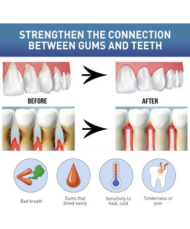 Premium Gums Therapy Gel & Tooth Stain Remover - Periodontal Treatment for Sensitive Teeth (5PC) - Buy Online on GoSupps.com