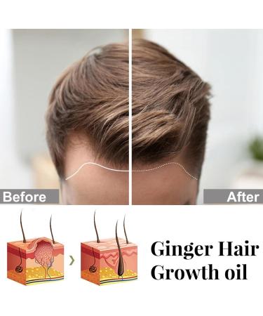 BAOK Hair Care - Moisturizing Hair Care Oil - Hydrating and Nourishing Hair Growth 1 oz for Damaged Bleached and Dry Hair - Buy Online on GoSupps.com
