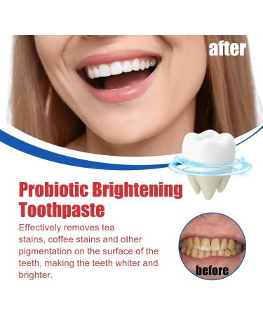 SP-6 Ultra Whitening Toothpaste - Fresh Breath Stain Removal & Probiotics - Jasmin Mint 4.23oz - International Shipping Available - Buy Online on GoSupps.com