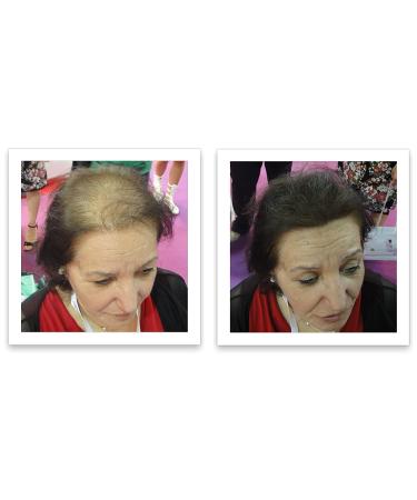 Dark Brown Hair Loss Concealer Trial Size - Cover Bald Spots Instantly - 10-Day Supply - All-Natural Fiber Formula - Buy Online on GoSupps.com