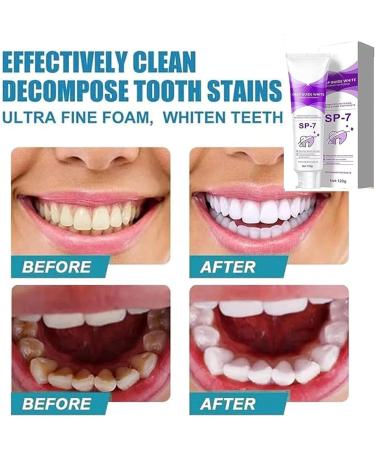 SP-7 Probiotic Whitening Toothpaste - Brightening & Stain Removing Healthy Teeth & Gums Prevents Tartar (2 PCs) - International Shipping Available - Buy Online on GoSupps.com