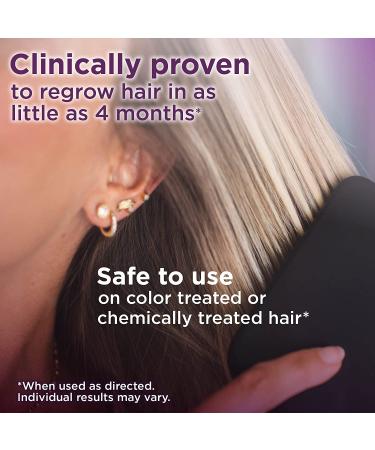 Amazon Basic Care Minoxidil 2% Topical Solution for Women - Hair Regrowth Treatment, 3 Count - Buy Online on GoSupps.com