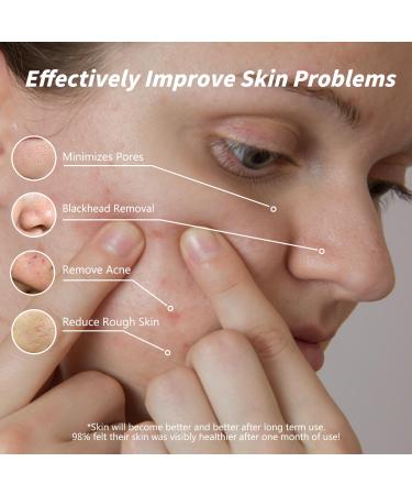Unes Rosemary Pore Clay Mud Mask - Deep Cleansing for Blackheads & Oily Skin | Natural Face & Body Care - 7.05oz - Buy Online on GoSupps.com