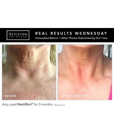 Revision Skincare Nectifirm Tube 8 oz - Advanced Neck Firming Cream - Buy Online on GoSupps.com