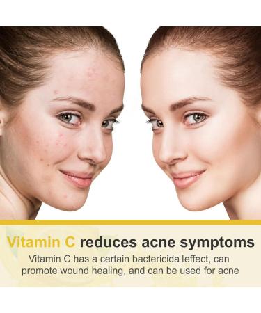 Shop Vitamin C Cream - Anti-Aging Face Moisturizer with Hyaluronic Acid & Niacinamide for Wrinkle Reduction | International Shipping - Buy Online on GoSupps.com