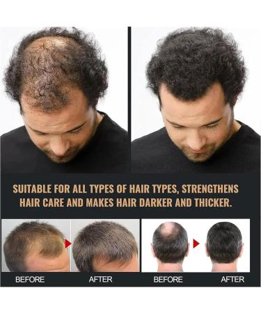 Root Activating Shampoo Shampoo Natural Hair Shampoos Long Lasting Nourishing Hair Care For Men And Women (1pc) - Buy Online on GoSupps.com