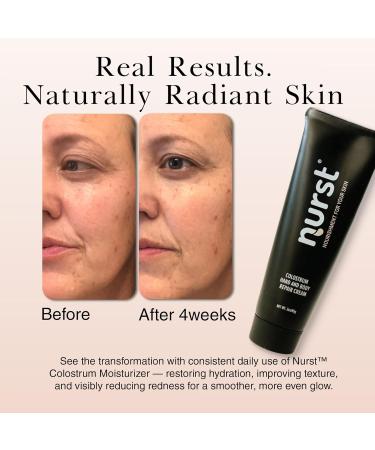 Nurst Colostrum Daily Face Moisturizer - Lightweight Hydrating Cream with Natural Citrus Scent - Daily Facial Moisturizer for All Skin Types - Niacinamide Hyaluronic Acid - Buy Online on GoSupps.com