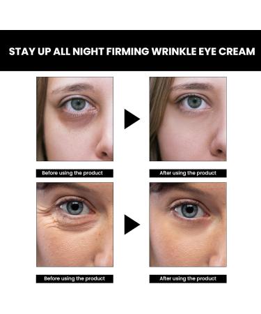 Celyz Eye Cream Celyn Instant Firm Eye Cream Ceeyn Eye Tightener for Puffiness and Bags Under Eyes Fade Fine Lines (3pc) - Buy Online on GoSupps.com
