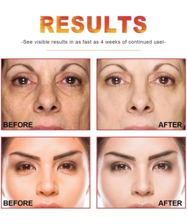 Organic C Oil for Face - 30ml Moisturizing & Brightening Glow Oil for Black Spot Removal | Natural Facial Care - Buy Online on GoSupps.com