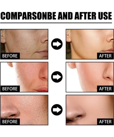 50ml Facial Nicotinamide Serum Nicotinamide Hydrating Serum Spots Removal Minimizing Pores Nicotinamide Brightening - Buy Online on GoSupps.com