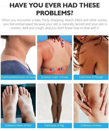 EXQST Whitening Cream Body Whitening Cream Whitening Cream Moisturizing Brightening Body Lotion Whitening Cream for Dark Skin - Buy Online on GoSupps.com