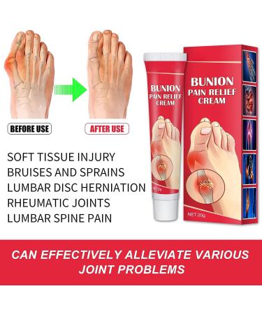 Refreshing Bunion Cream for Toe Swelling Relief - Gentle and Safe Health Care Solution - Buy Online on GoSupps.com