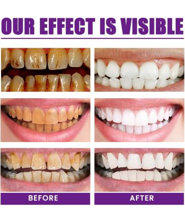 Purple Toothpaste for Teeth Purple Whitening Toothpaste for Yellow Tooth Gentle Teeth Stain Remover Refresh - Buy Online on GoSupps.com