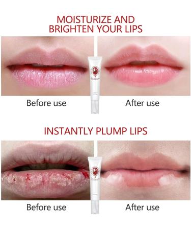 Lip Serum Korean Dark Lip Serum vitamine Elippenserum 18 g Moisturizer Nourishing Essence Remove Dark Lips Fresh Treatment Nonstick 5 - Buy Online on GoSupps.com
