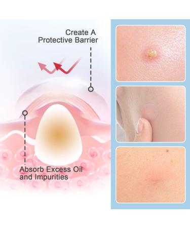 Invisible Pimple Patches - 110 Ultra Thin Hydrocolloid Acne Dots for Daytime Use - Effective Whitehead Treatment - Buy Online on GoSupps.com