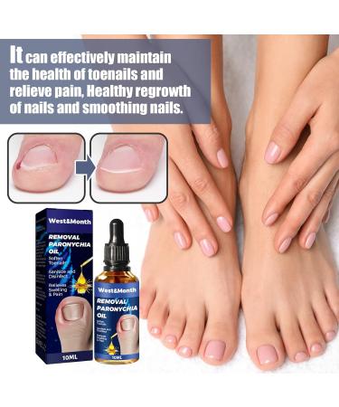  LWuuywa German Toenailplus Anti-Paronychia Relief Oil 10ml Correction Treatment Oil Nail Care Nail Growing Anti-Paronychia Aid Oil Ingrown Nail Drops - Buy Online on GoSupps.com