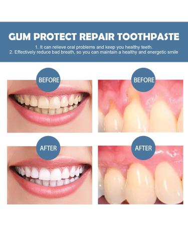  G n rique Gum Care Gel Teeth Repair Gel Gum Restoration Drops Essence Teeth Whitening Toothpaste Fresh Breath Cleaning Tooth Protection & Oral Care (2) - Buy Online on GoSupps.com
