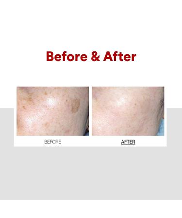 Medi-Peel Melanon X Cream 1.01 fl oz - Dark Spot Reducer & Anti-Aging Treatment - Buy Online on GoSupps.com